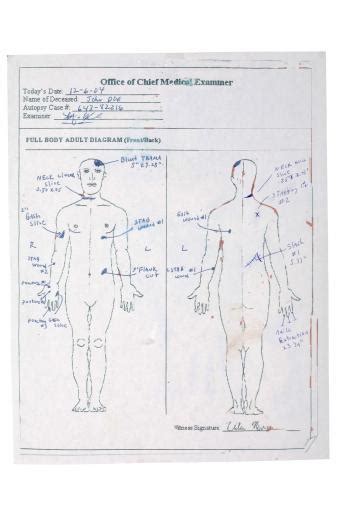 His face & head were wrapped in sweatshirt . . Chris and channon autopsy report